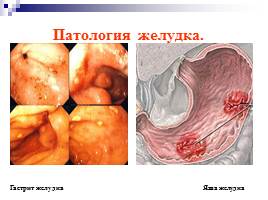 Пищеварительная система человека, слайд 33