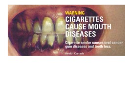 Мини-проект «Курение и здоровье», слайд 53
