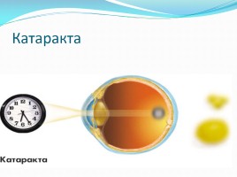 Гигиена зрения, слайд 11
