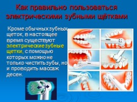 Как правильно ухаживать за зубами, слайд 12