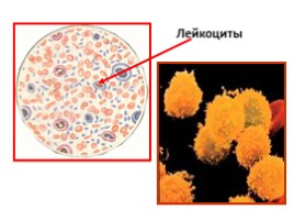 Зачёт по теме «Кровообращение», слайд 8