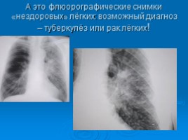 Здоровье дыхательной системы - здоровье всего организма, слайд 12