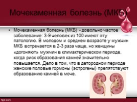 Мочекаменная болезнь, слайд 3
