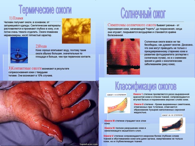 Презентация Уход за кожей Гигиена одежды и обуви