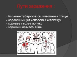 Туберкулёз в России, слайд 5