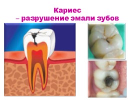 Строение и функции зубов, слайд 16