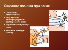 ОБЖ в 9-11 классе «Раны - способы остановки кровотечений», слайд 9