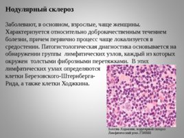 Опухоли кроветворной и лимфоидной тканей Часть II, слайд 51
