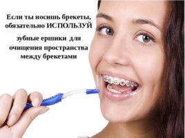 Как и чем чистить зубы. Предметы и средства гигиены полости рта. Методы чистки зубов., слайд 9