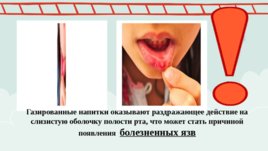 Роль питания в профилактике стоматологических заболеваний, слайд 6