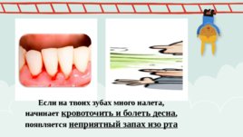 Роль питания в профилактике стоматологических заболеваний, слайд 9