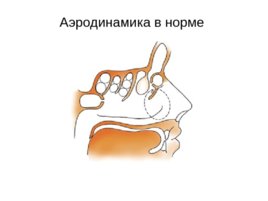 Анатомия, физиология носа, слайд 23
