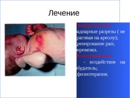 Гнойно-восполительные заболевания кожи и подкожной клетчатки у детей, слайд 42