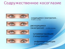 Патология глазодвигательного аппарата, слайд 14