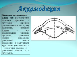 Ухудшение зрения у школьников и пути решения проблемы, слайд 9