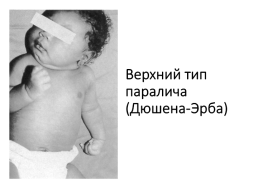 Асфиксия новорожденного. Родовая травма., слайд 36
