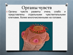 Ленточные черви на примере свиного цепня, слайд 9