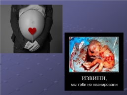 Аборт и контрацепция-радость полноценной жизни или утрата счастья?, слайд 11