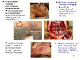 Травматология (общие вопросы), слайд 32