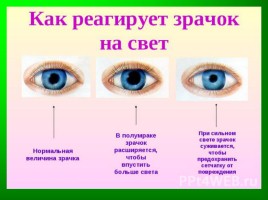 Исследовательская работа на тему: «Берегите зрение», слайд 10