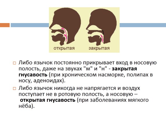 Презентация «Гнусавость - Виды и устранение»