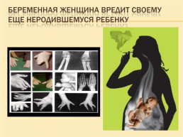 Курение или здоровье, слайд 14