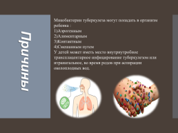 Туберкулез у детей, слайд 3