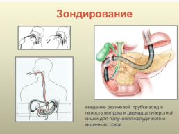 Методы исследования органов пищеварения, слайд 6