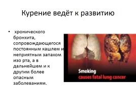 Классный час «О вреде курения», слайд 19