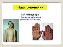 Эндокринная система человека, слайд 12