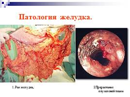 Пищеварительная система человека, слайд 32