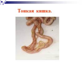 Пищеварительная система человека, слайд 35