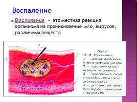 Борьба организма с инфекцией - Иммунитет, слайд 7