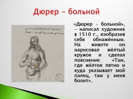 Возрождение в Италии - Северное возрождение, слайд 216