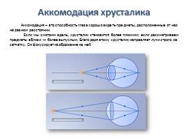 Орган зрения и зрительный анализатор, слайд 6