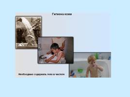 Открытый урок по теме «Строение и значение кожи - Гигиена кожи», слайд 17