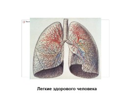Мини-проект «Курение и здоровье», слайд 13