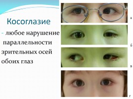 Гигиена зрения, слайд 9