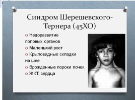 Наследственные болезни человека, слайд 11