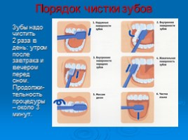 Как правильно ухаживать за зубами, слайд 13