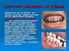 Как правильно ухаживать за зубами, слайд 6