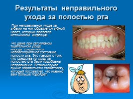 Как правильно ухаживать за зубами, слайд 7