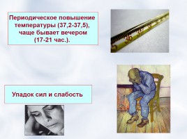 Защити себя от туберкулеза!, слайд 17