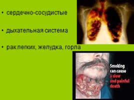 Исследовательская работа «Вред курения», слайд 11