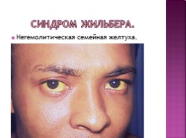 Генетика - Здоровье человека, слайд 22