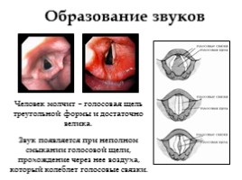 Дыхательная система, слайд 20