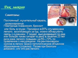 Здоровье дыхательной системы - здоровье всего организма, слайд 16