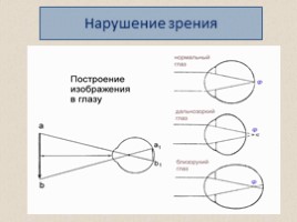 Зрительный анализатор, слайд 11