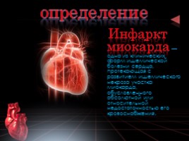 Первая медицинская помощь при инфаркте миокарда презентация