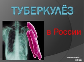 Туберкулёз в России, слайд 1